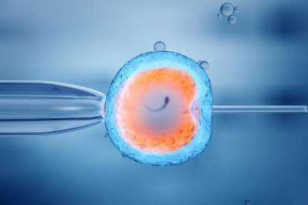 专家